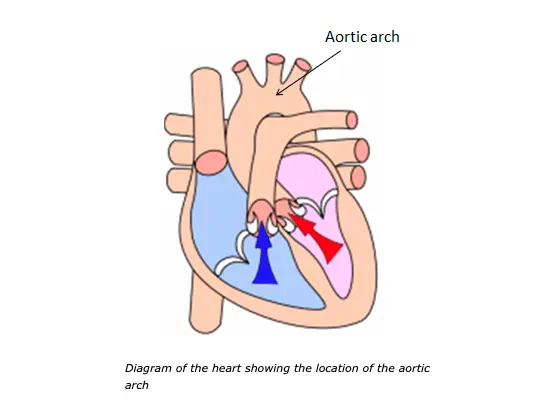 Where are the sensors for the arterial baroreceptor reflex located?